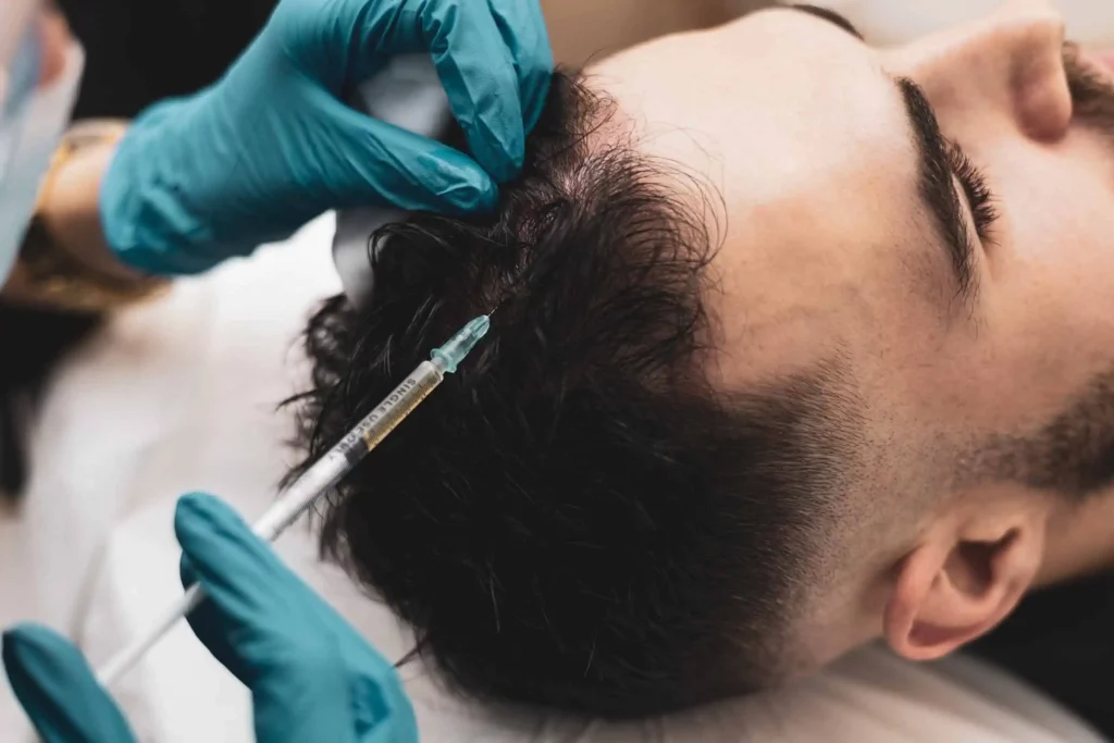 PRf Treatment for Hair Service | Samara Medspa