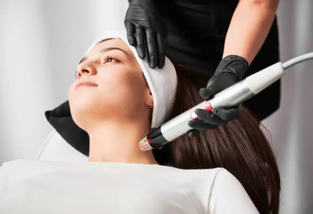 Microneedling