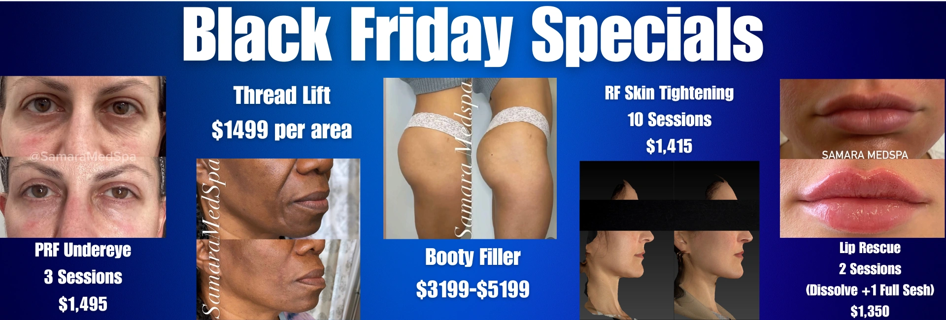 samaramedspa black friday specials 1