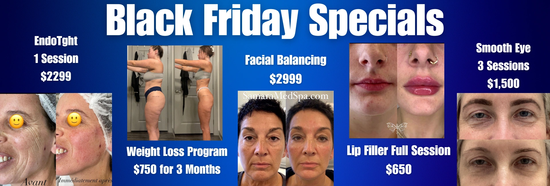 samaramedspa black friday specials 3