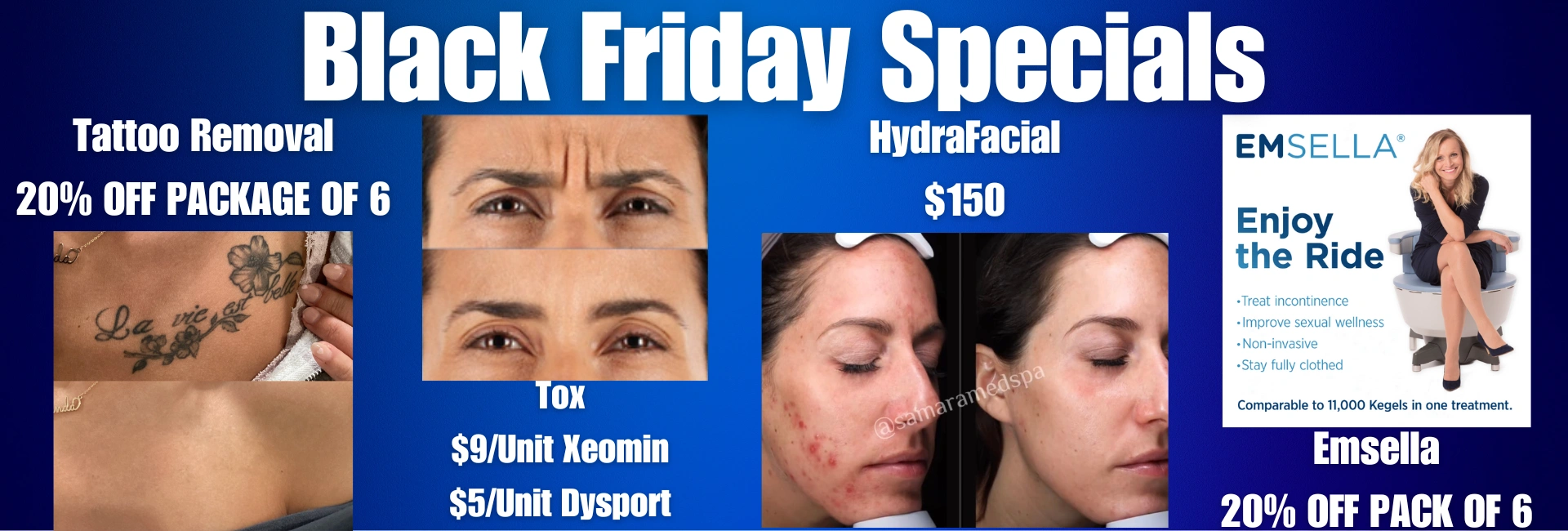 samaramedspa black friday specials 4