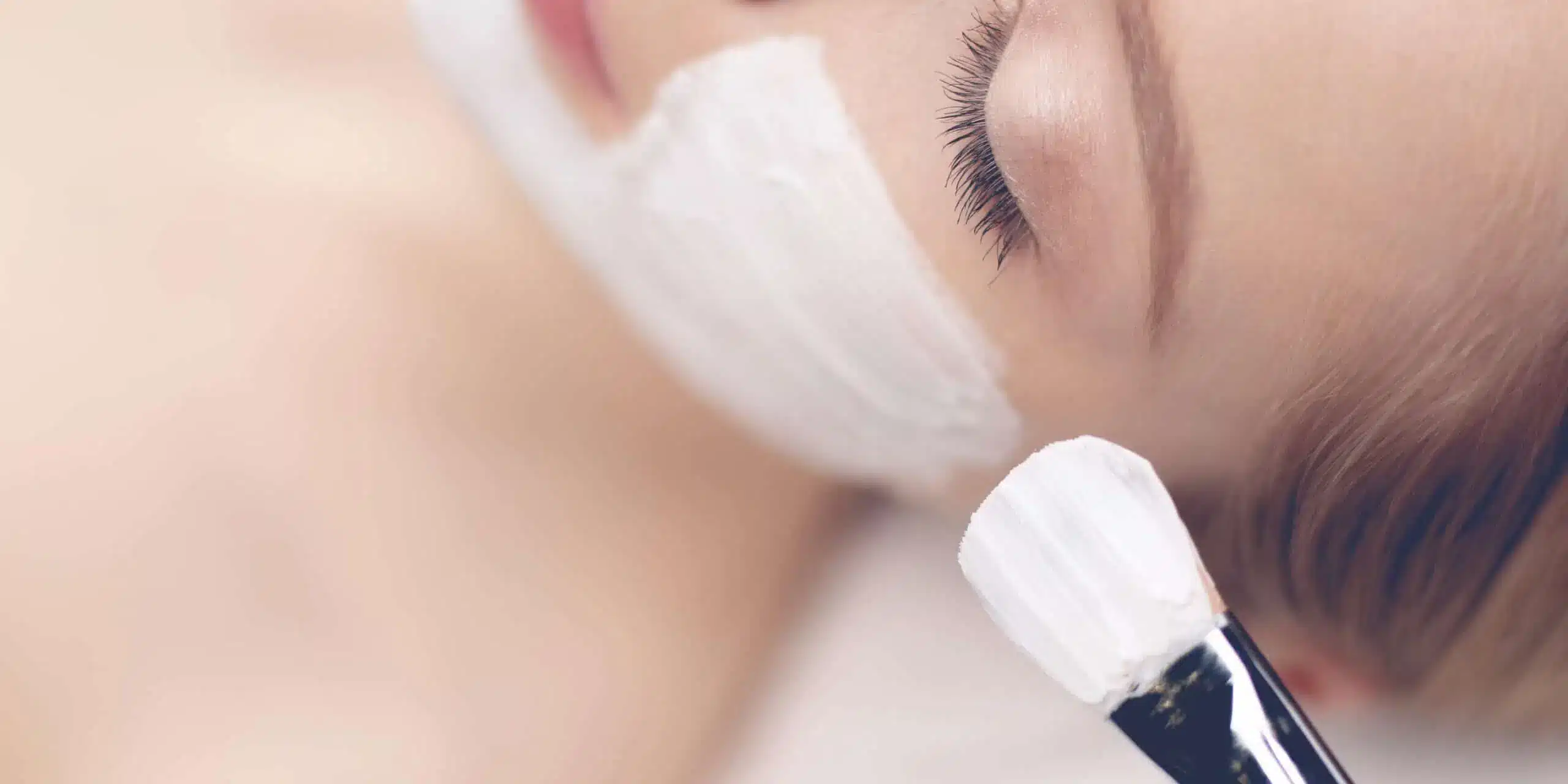 Chemical Peels for Wrinkles