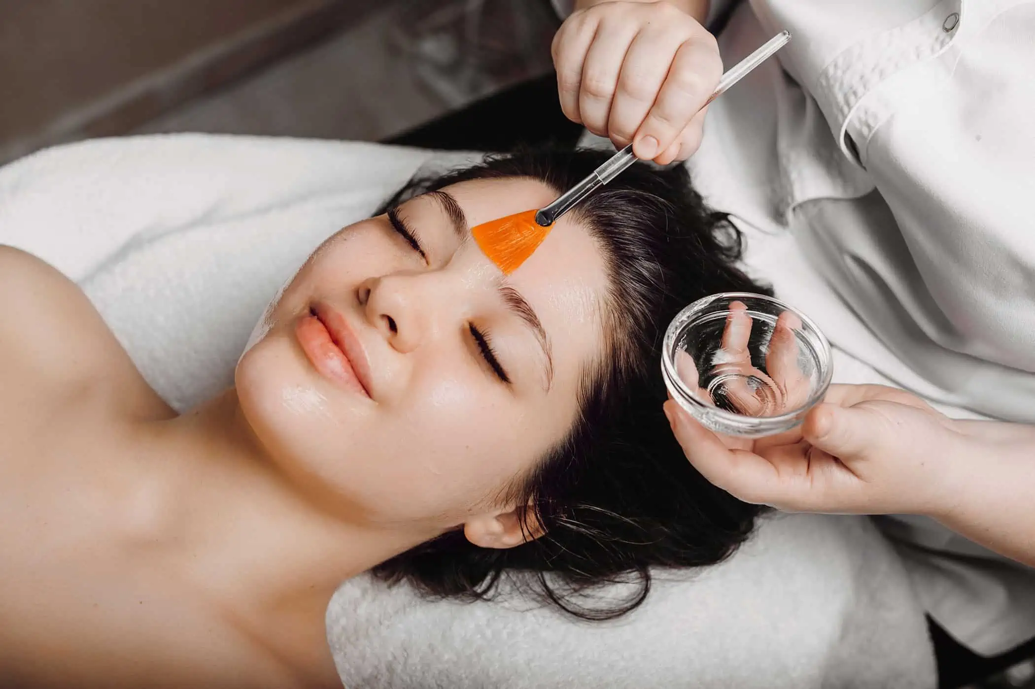 Chemical Peel Treatment in Avon