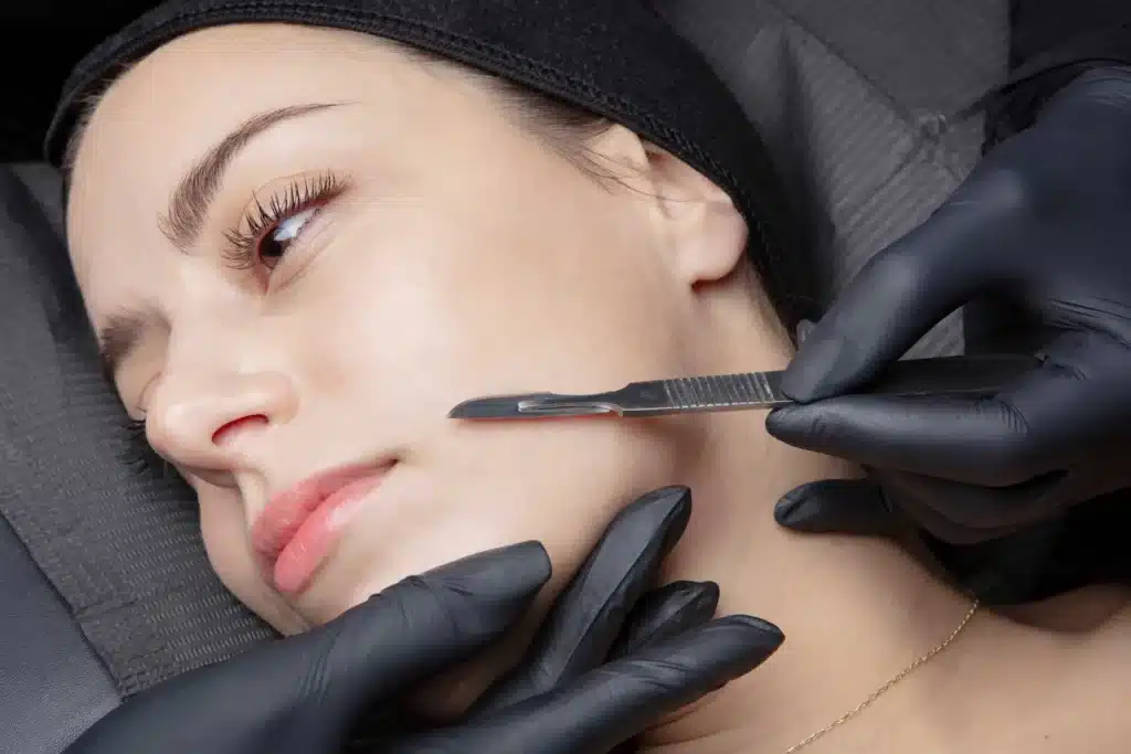 Dermaplaning Services in Avon