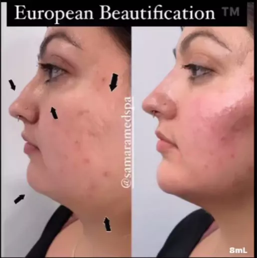European Beautification | Samara medspa