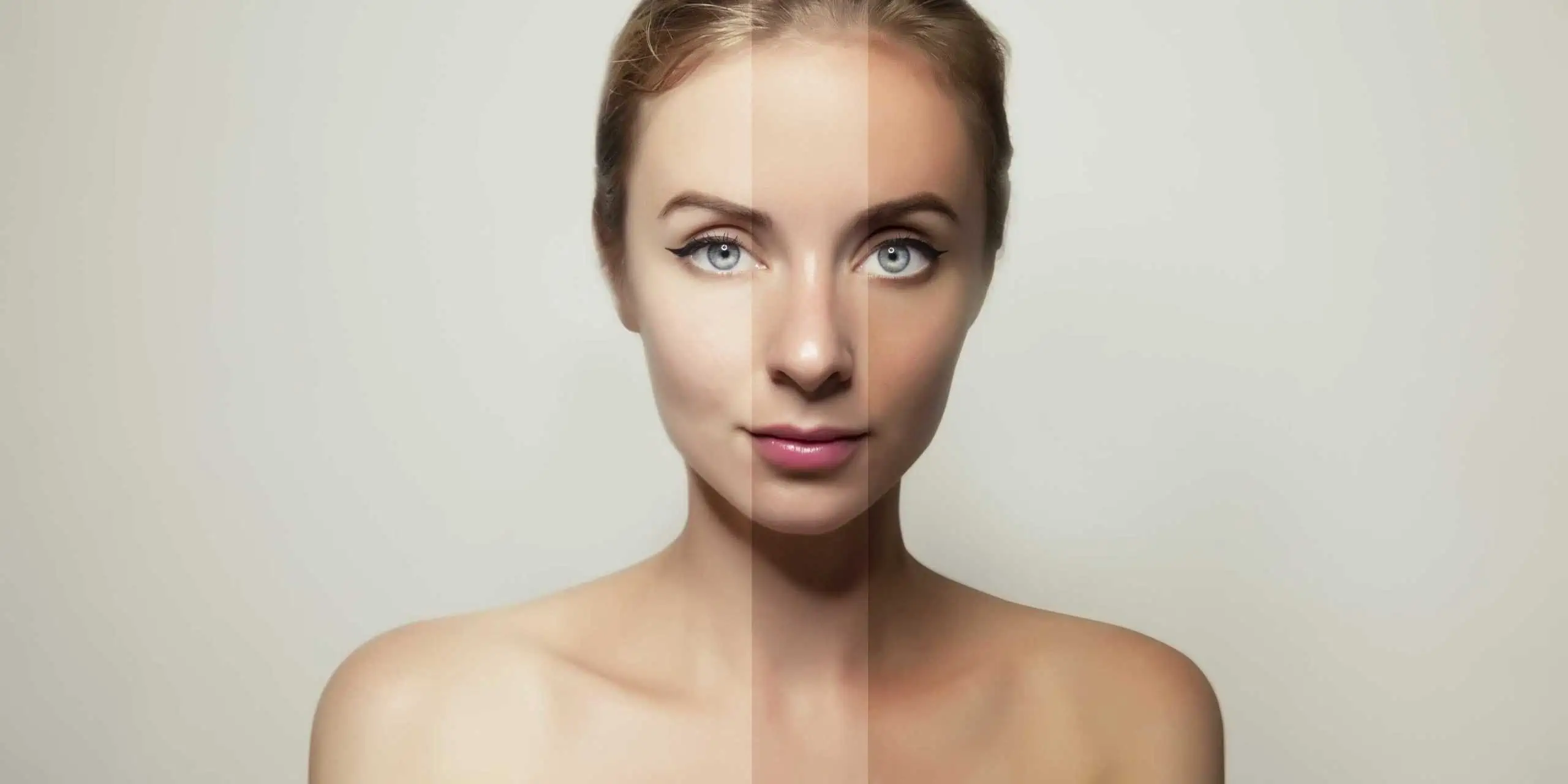 Laser Genesis for Skin Tone and Anti Aging