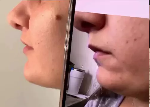 Lowe Face and LIps