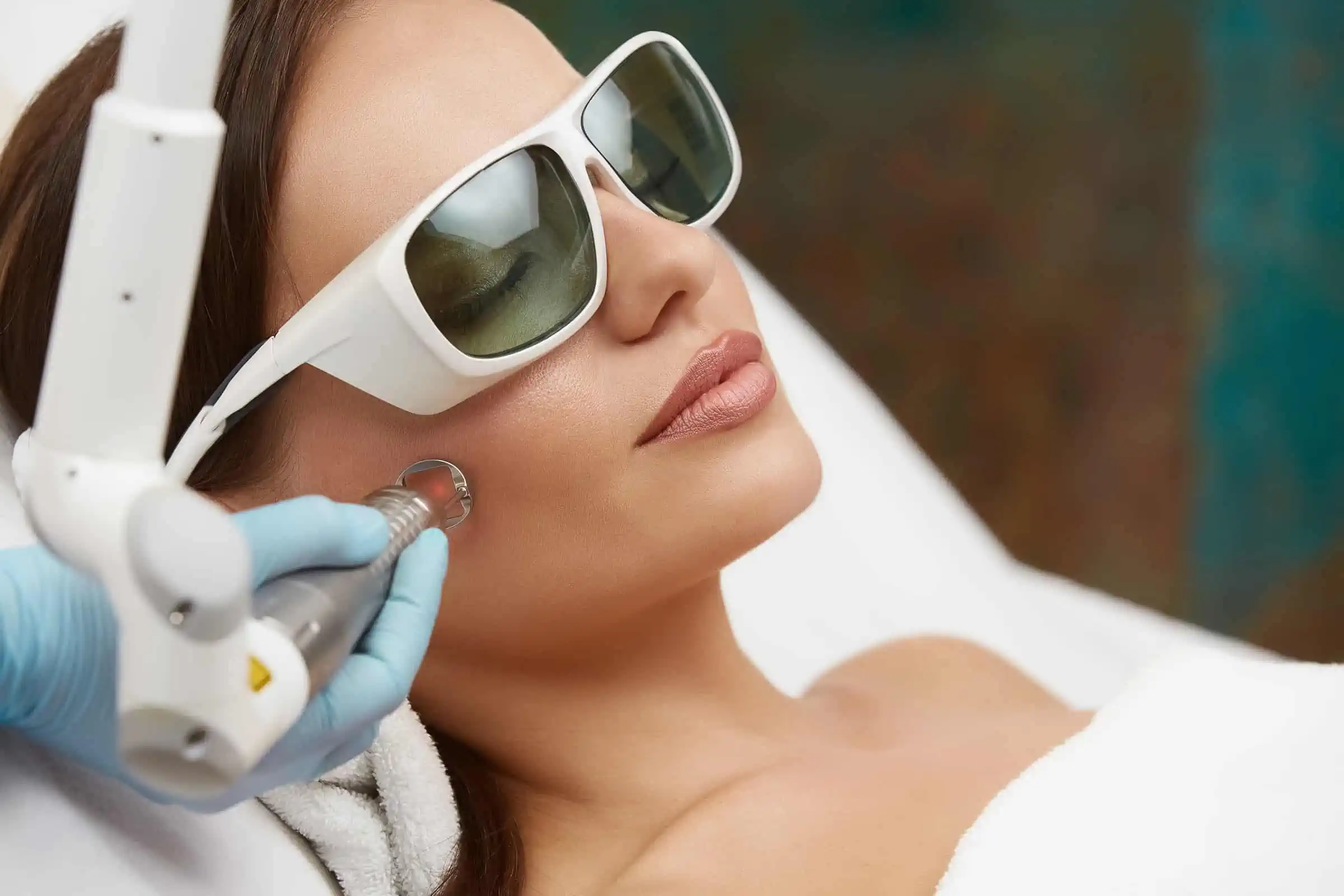 Pico Laser in Avon
