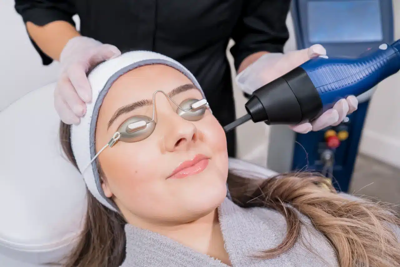CO2 Laser Resurfacing