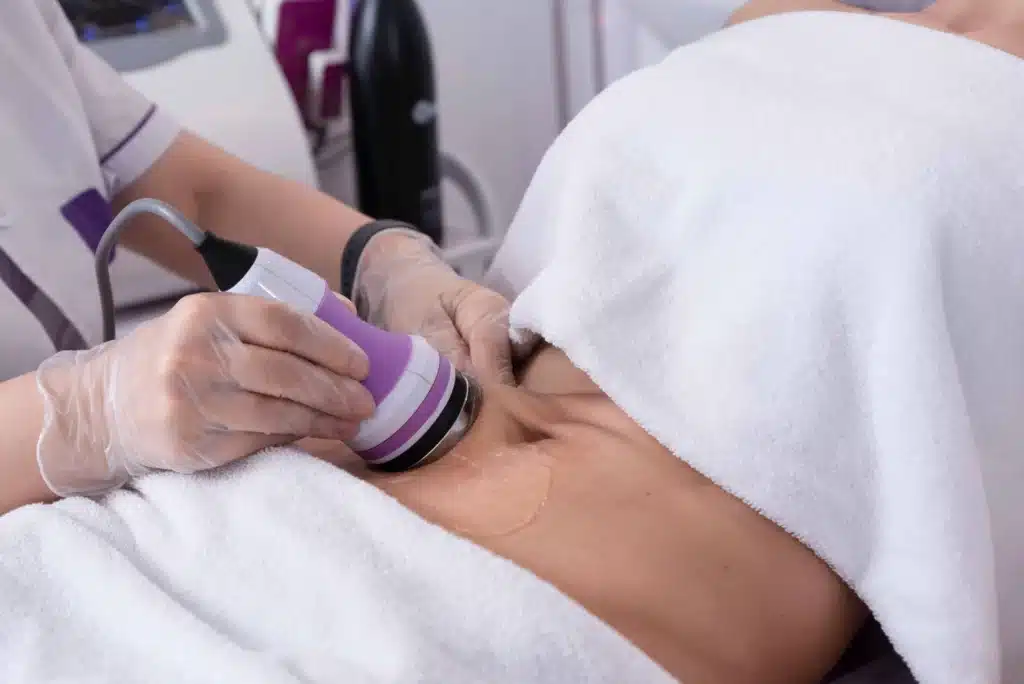 Cellulite Reduction Service | Samara Medspa