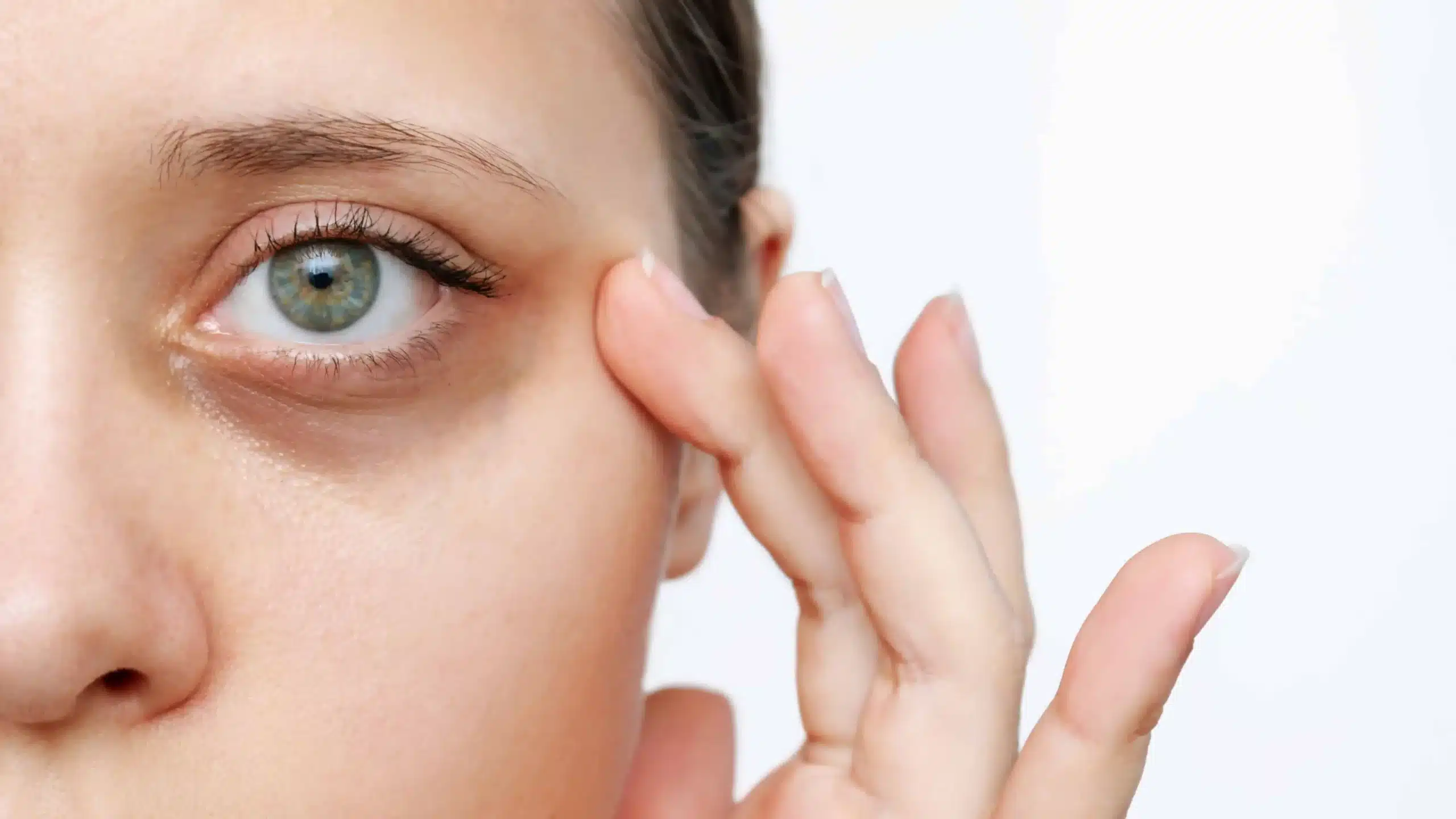 Dark Circle Service | Samara Medspa