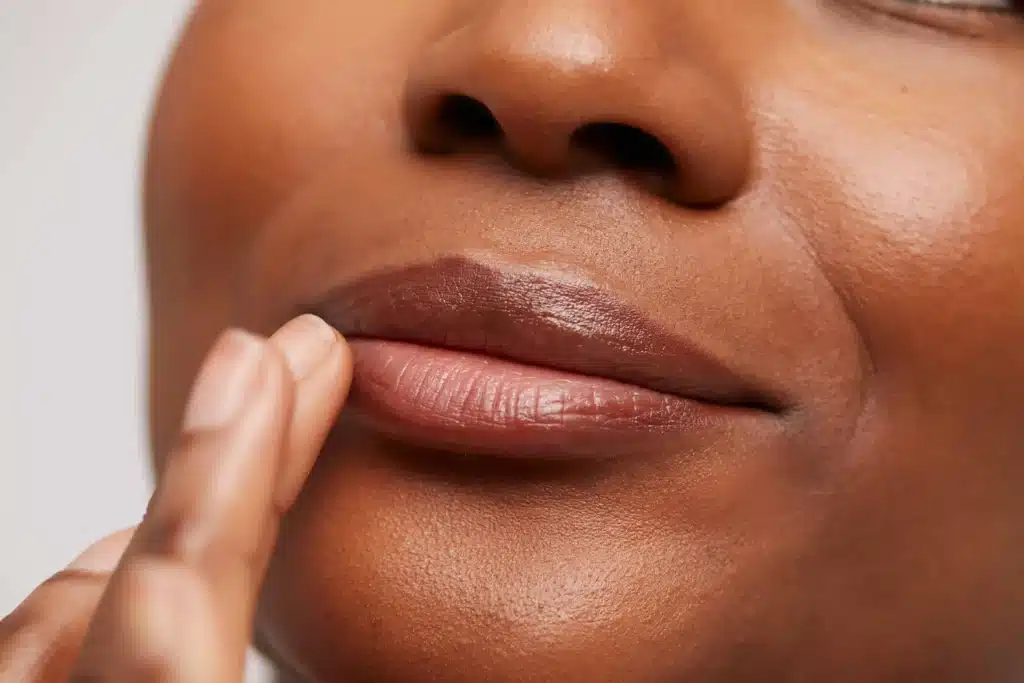 Scarred Lips | Samara Medspa