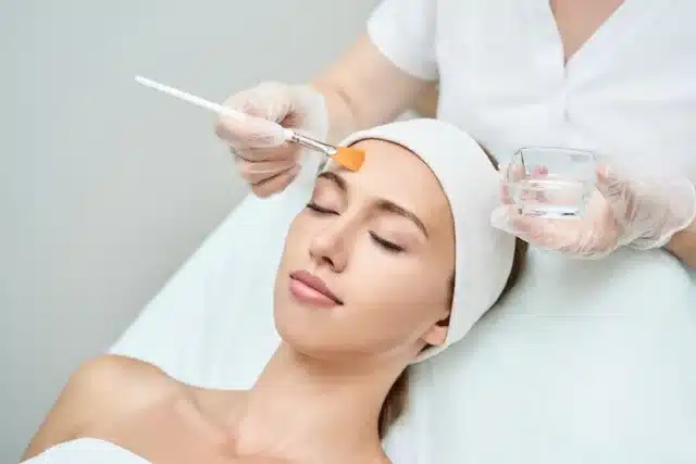 Deep Chemical Peels