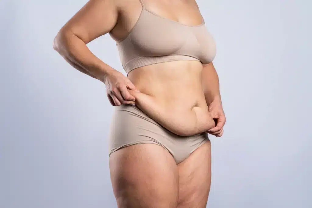 Body Treatments | Samara Medspa