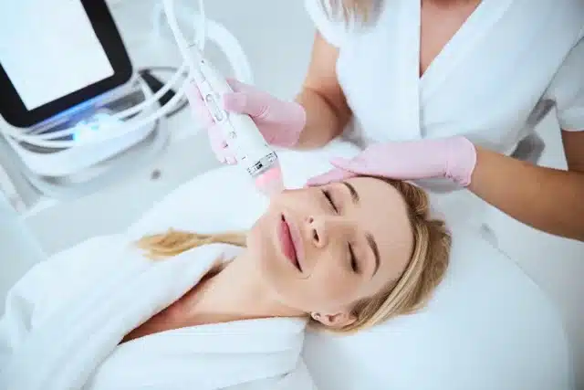 RF Microneedling