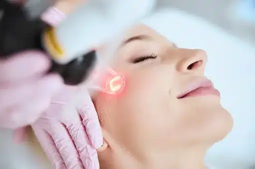 Nanofractional Resurfacing