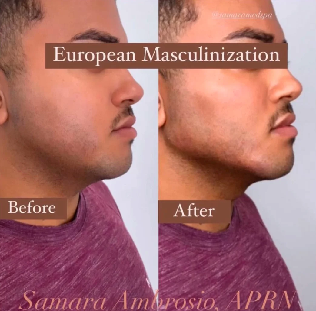 Before and After European Masculinization
