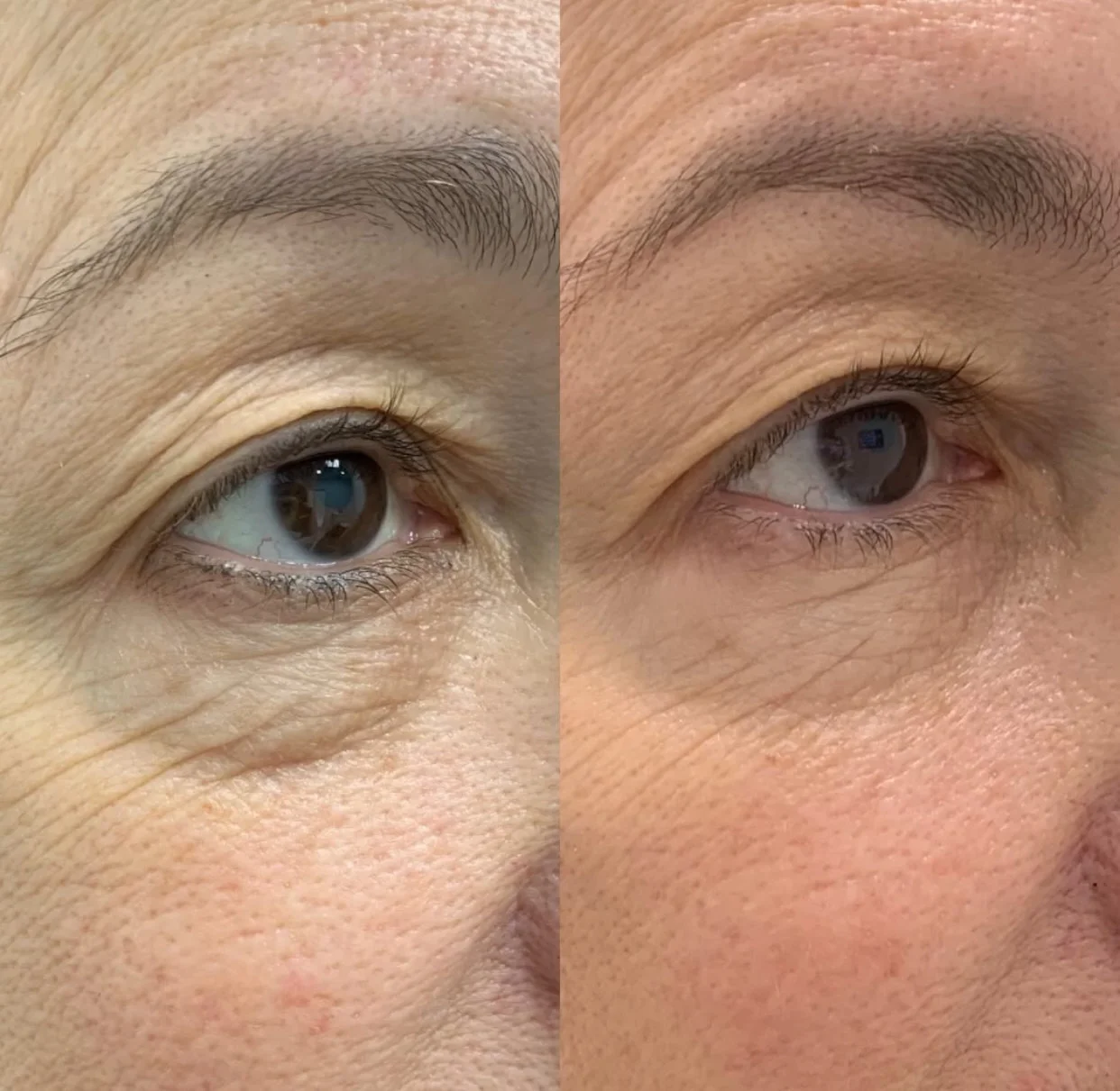 Skin Treatment Before and After