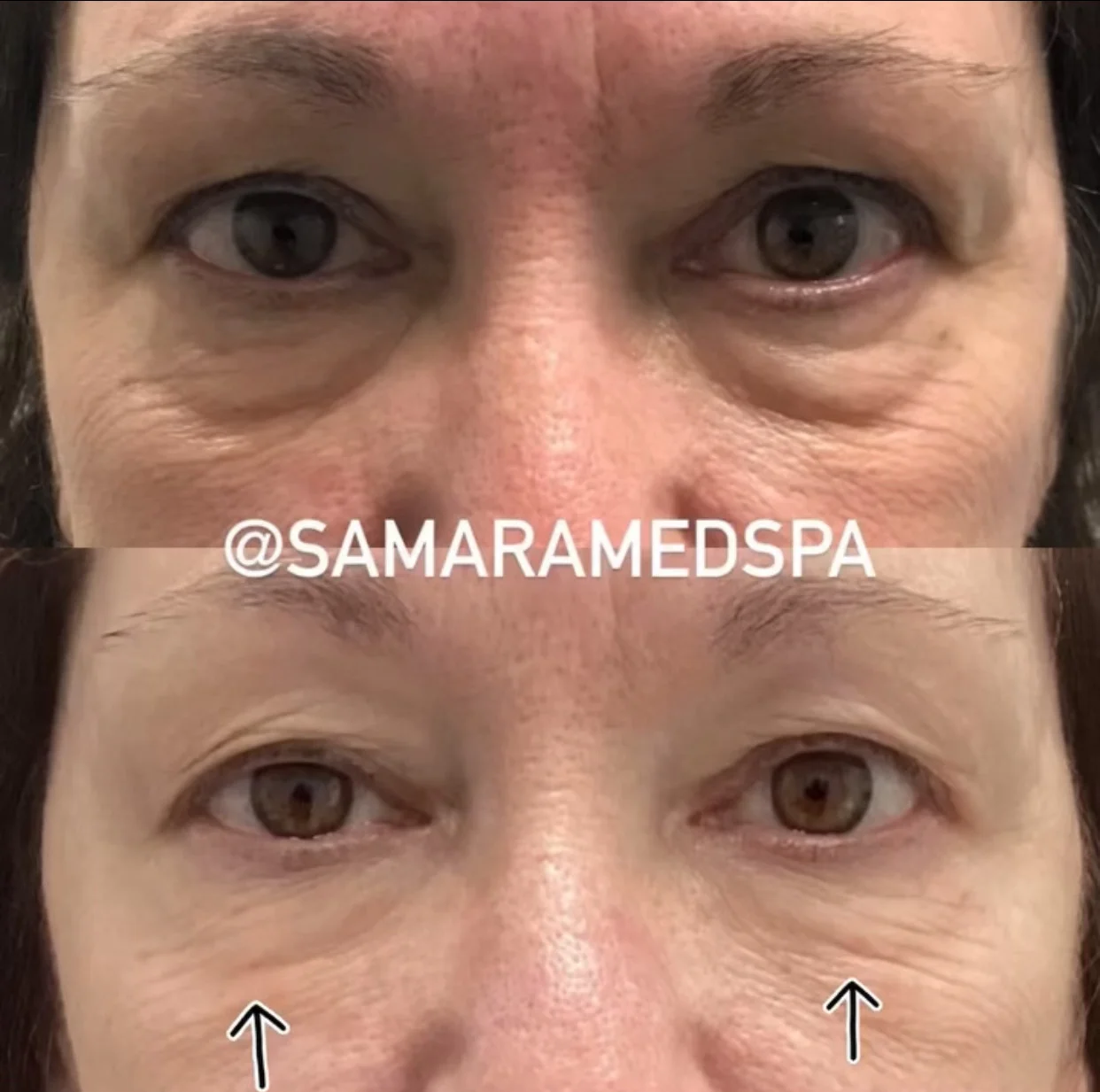 Samara Skin Treatment