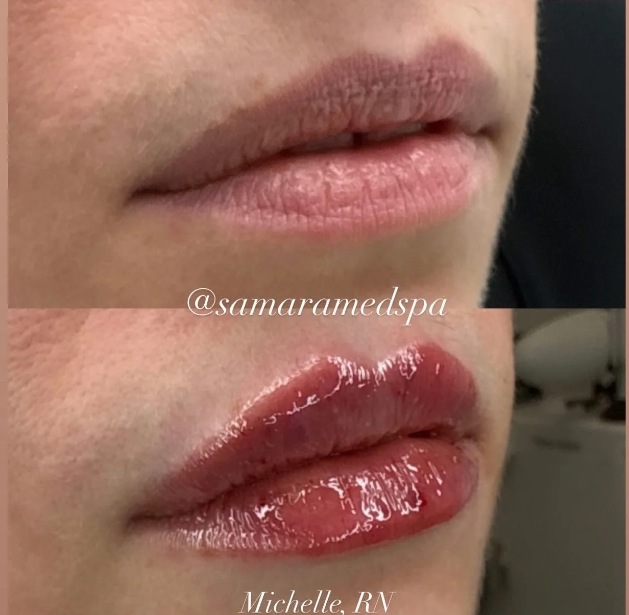 Before and After Michelle