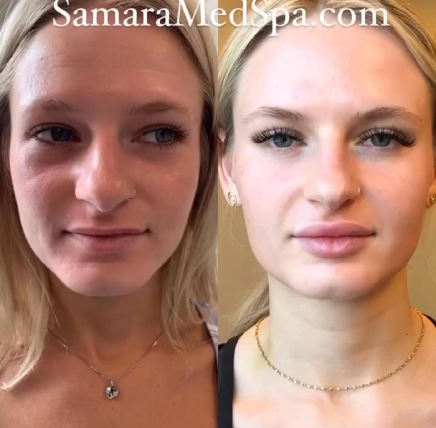 Skin treatment Before and After