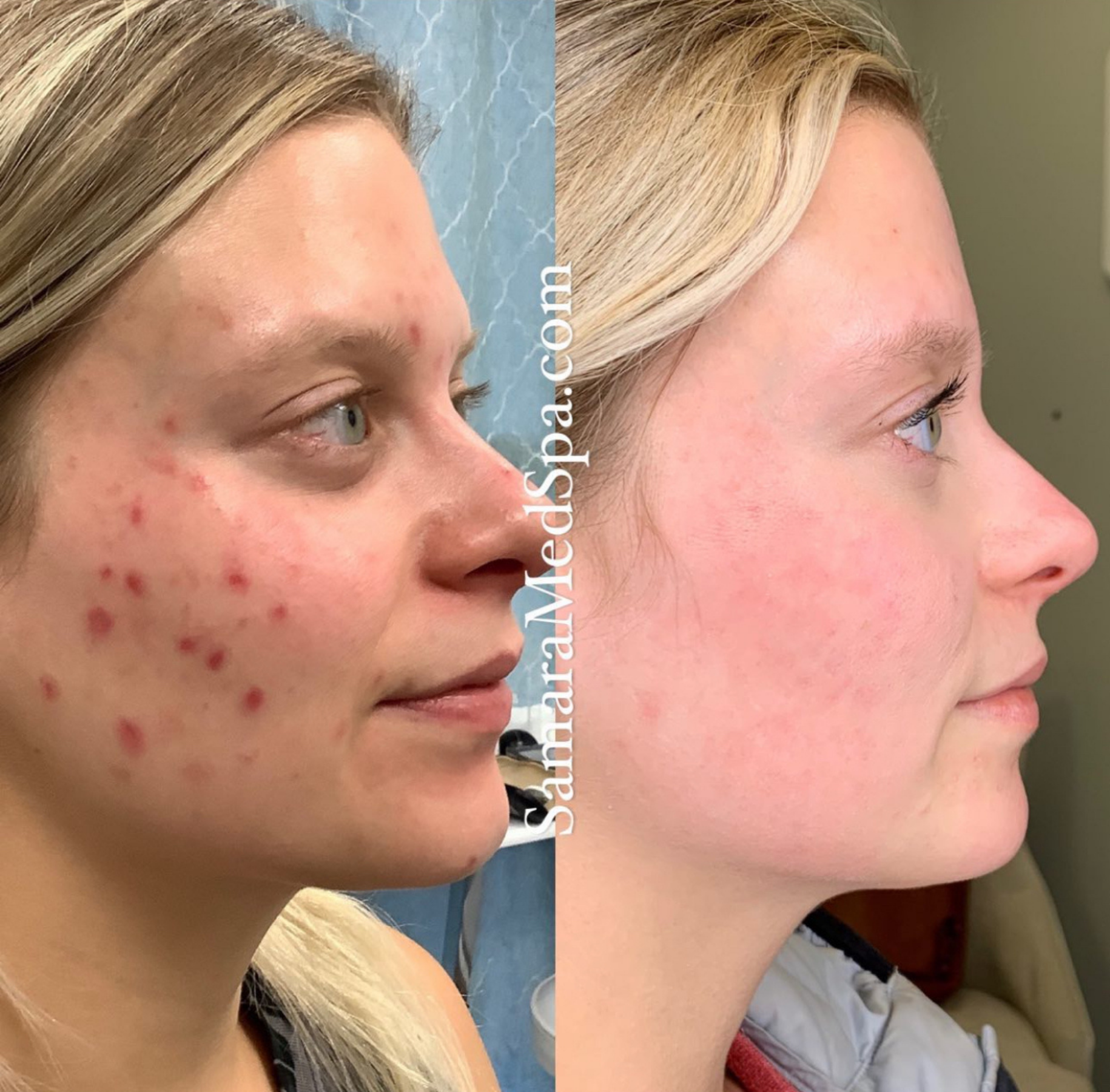 skin Treatment Face