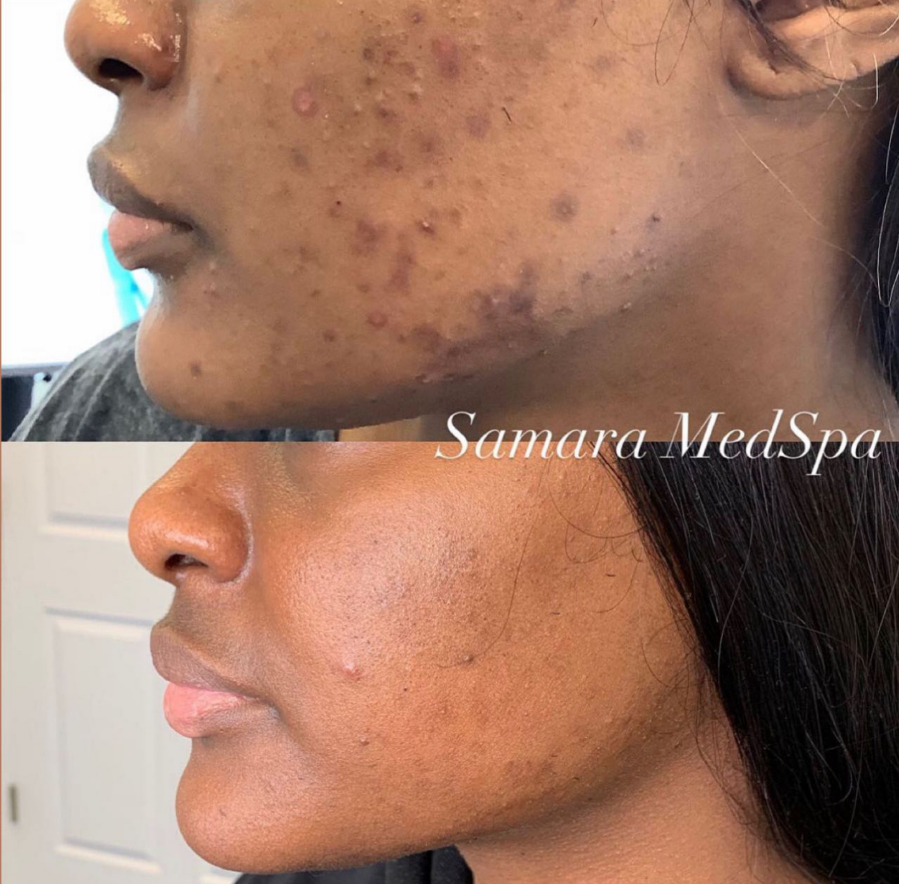 Samara Medspa Skin Treatment