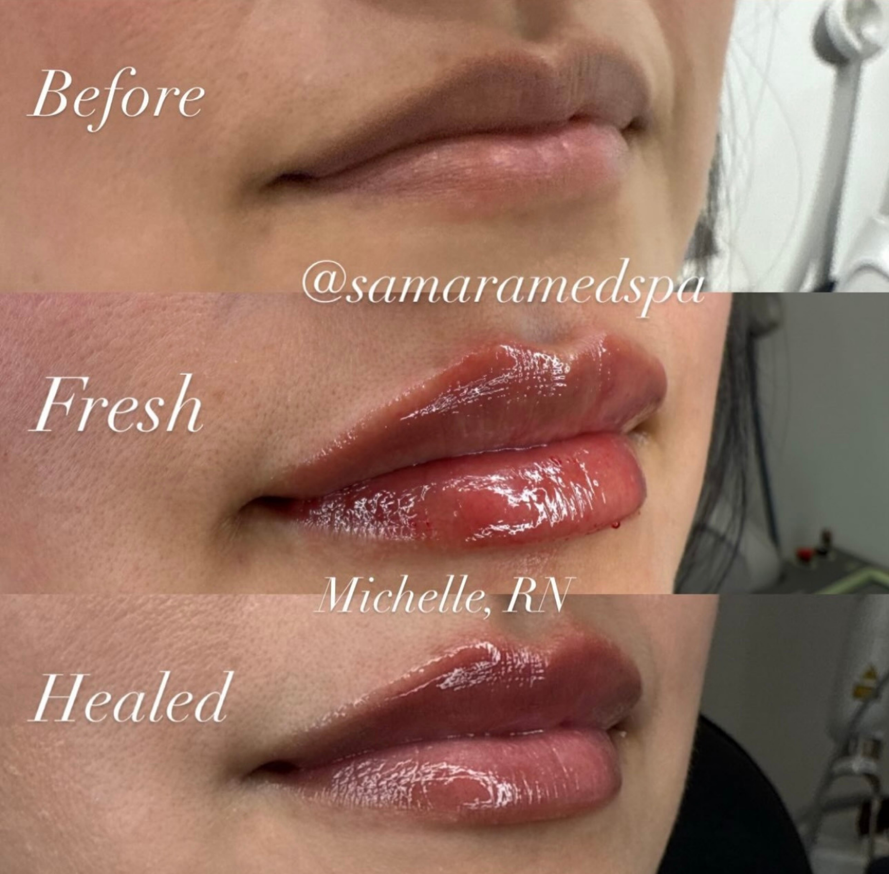 Michelle Before and After
