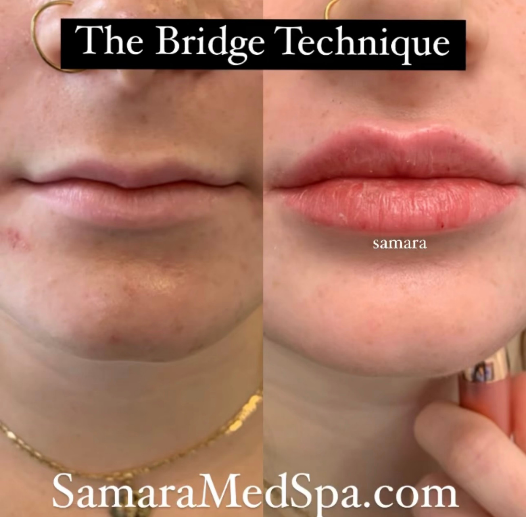 The Technique Bridge