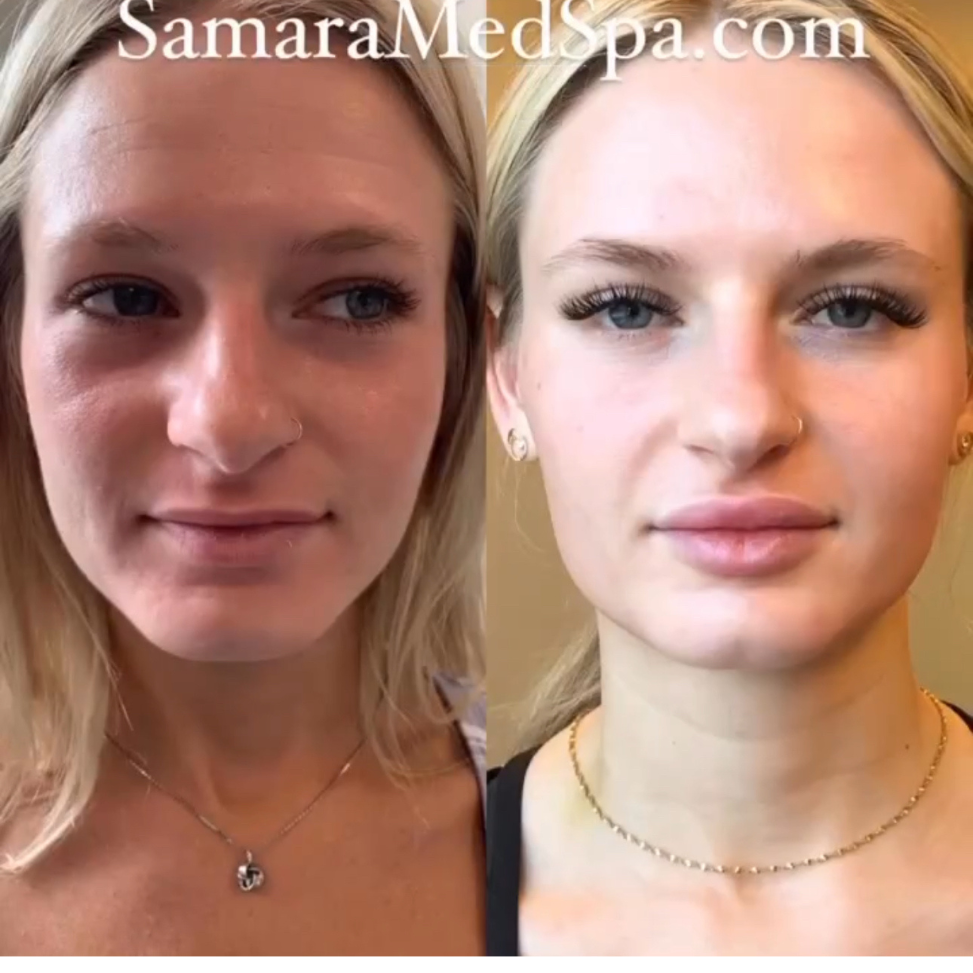Before and After Change